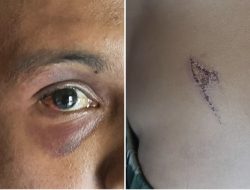 Mengaku Jadi Korban Pengeroyokan, Pemuda ini Malah dilaporkan ke Polisi